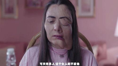 女畸形人,勇敢面对命运的挑战